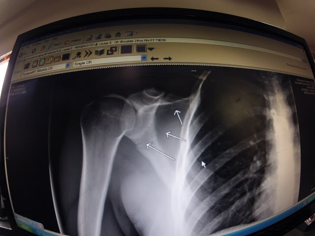 louise jull sport psychology canoe kayak whitewater river mental coaching extreme injury recovery self confidence new zealand icf tribe sportscene 